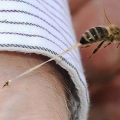 первая помощь при укусе пчелы или осы