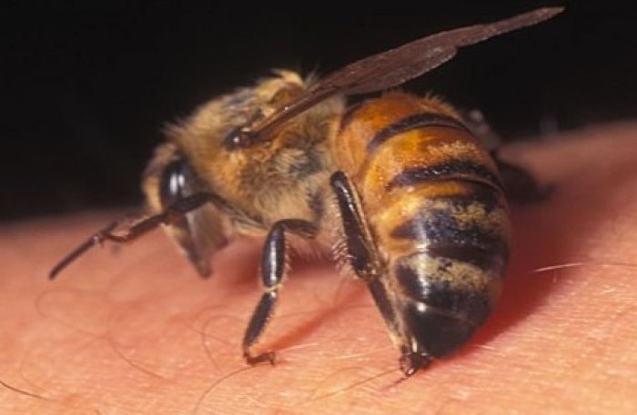 лечение пчелами вред и польза